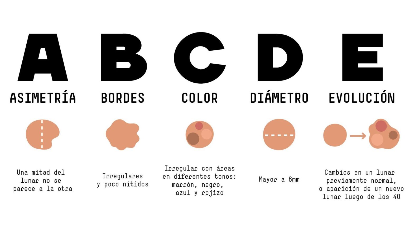 ABCDE rule for the early detection of melanoma