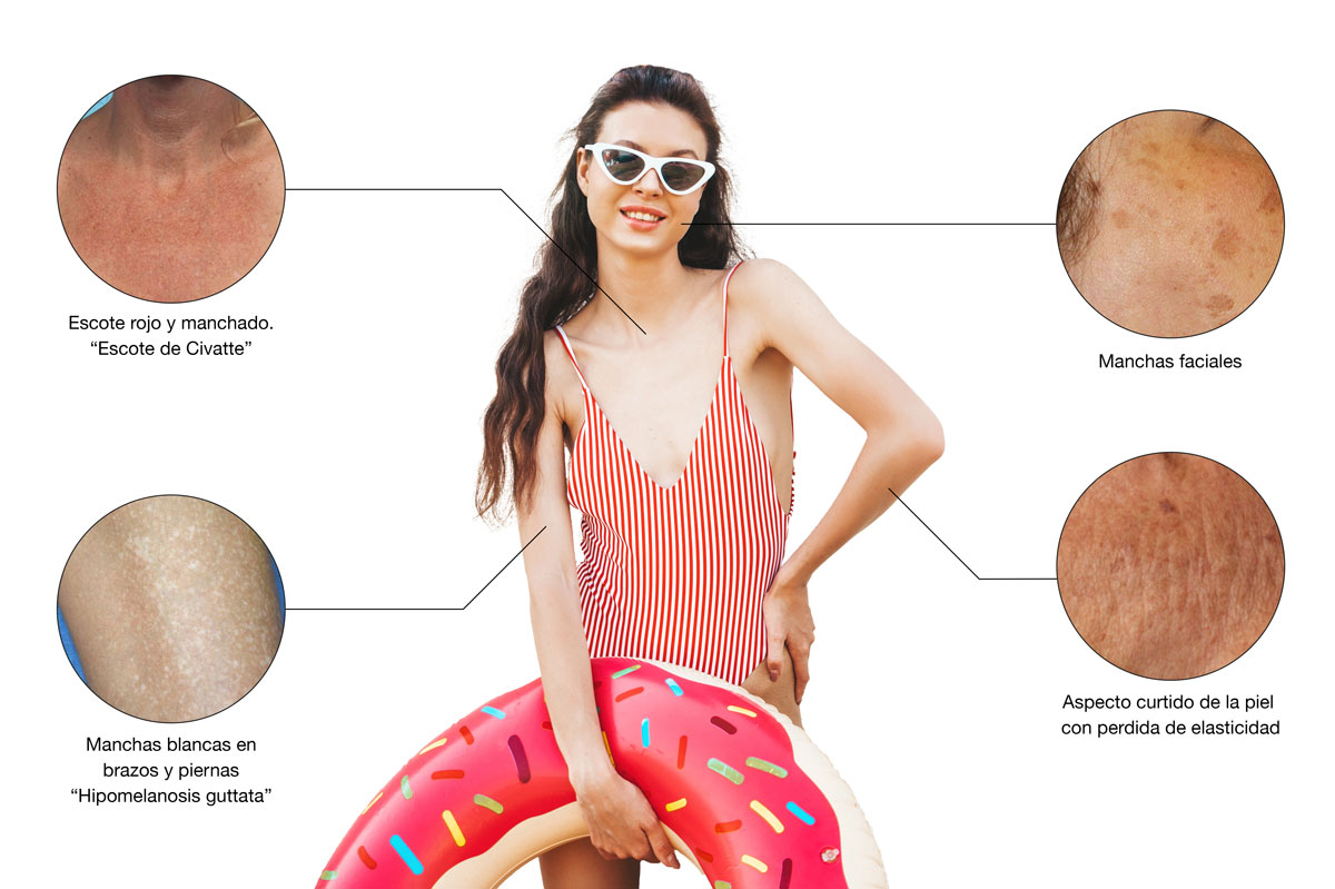 Woman modeling sun damage caused by not using the best sunscreens