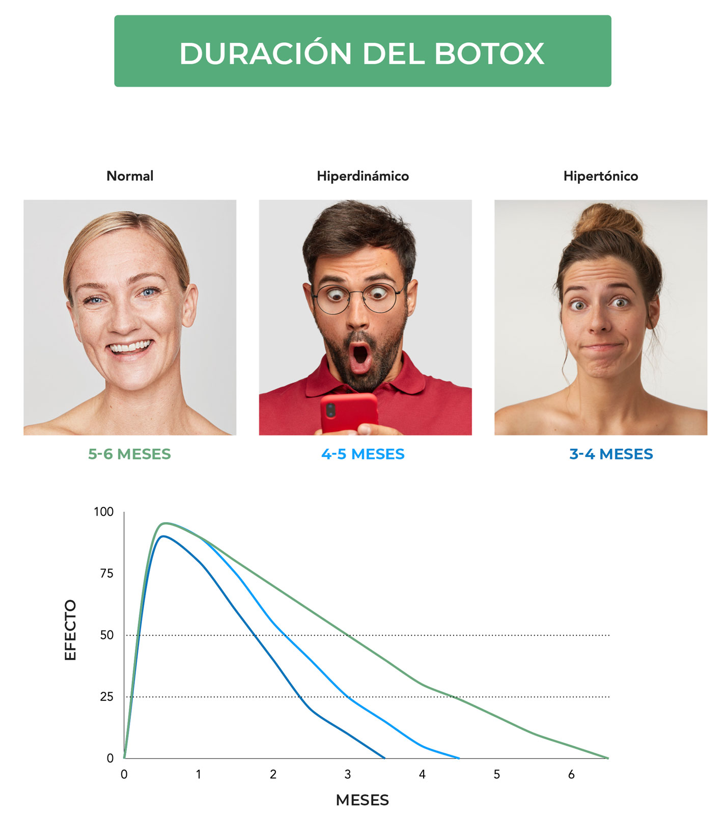 Ilustración que muestra la duración del botox dependiendo del tipo de contracción de cada paciente