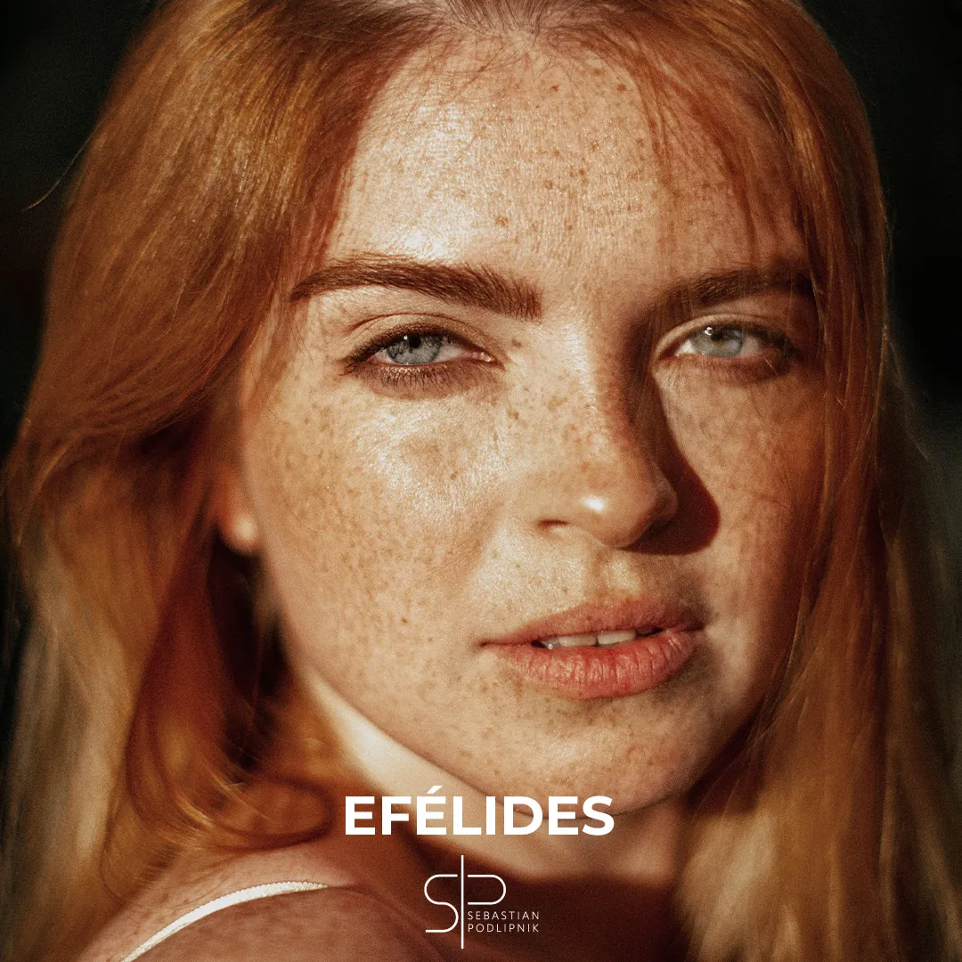 Portrait of a redhead with many ephelides or freckles on her face.