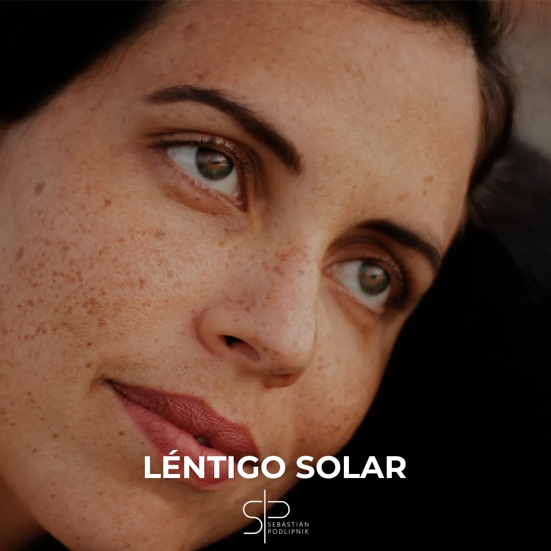 Portrait of a woman with sunspots on her face